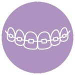Dental Braces | Affordable dental Farmington Hills MI | Smile America Dental Center