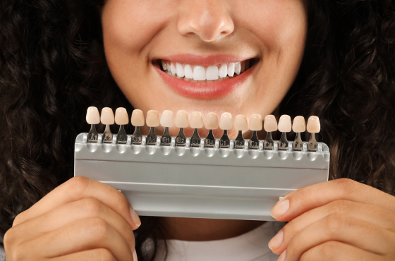 Teeth Veneer | Veneer Farmington Hills MI | Smile America Dental Center