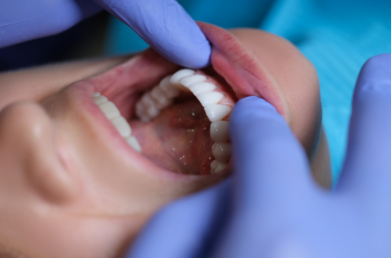 Oral Surgery | Pain Free Dentist Farmington Hills MI | Smile America Dental Center